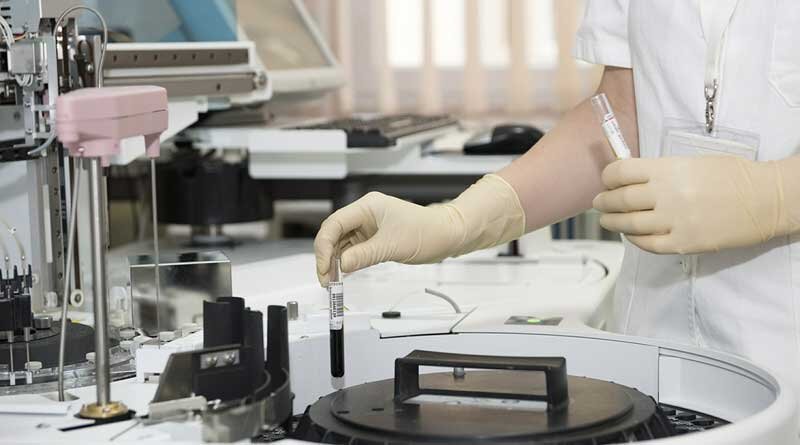 Running Found To Be Good For Health